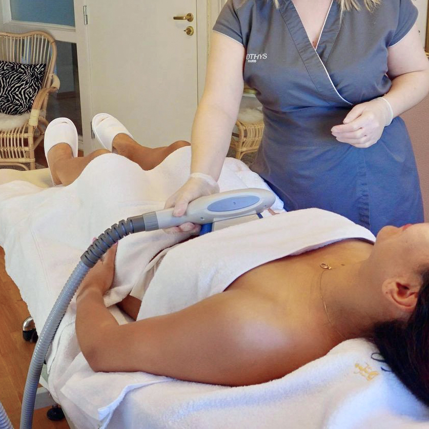 CoolSculpting CoolSculpting