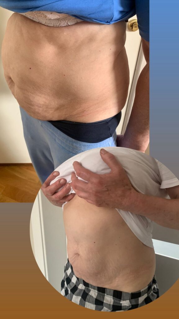 Signature-utvidet-Kontrastfettjerning​-3