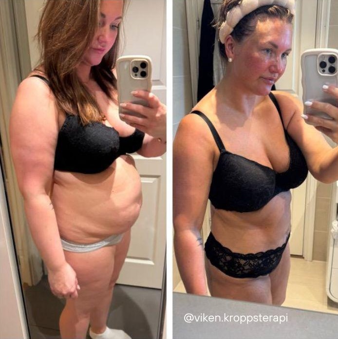 Signature utvidet Kontrastfettjerning​